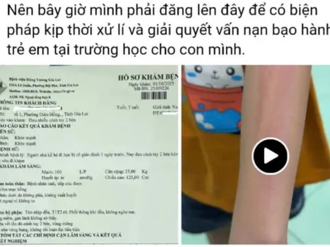 Nhà trường lên tiếng vụ cô giáo đánh học sinh lớp 2 gây xôn xao